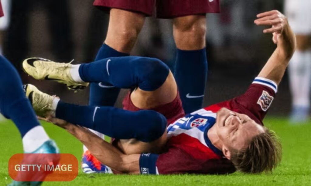 Odegaard Injury Sparks Concerns for Arsenal Ahead of Crucial Derby